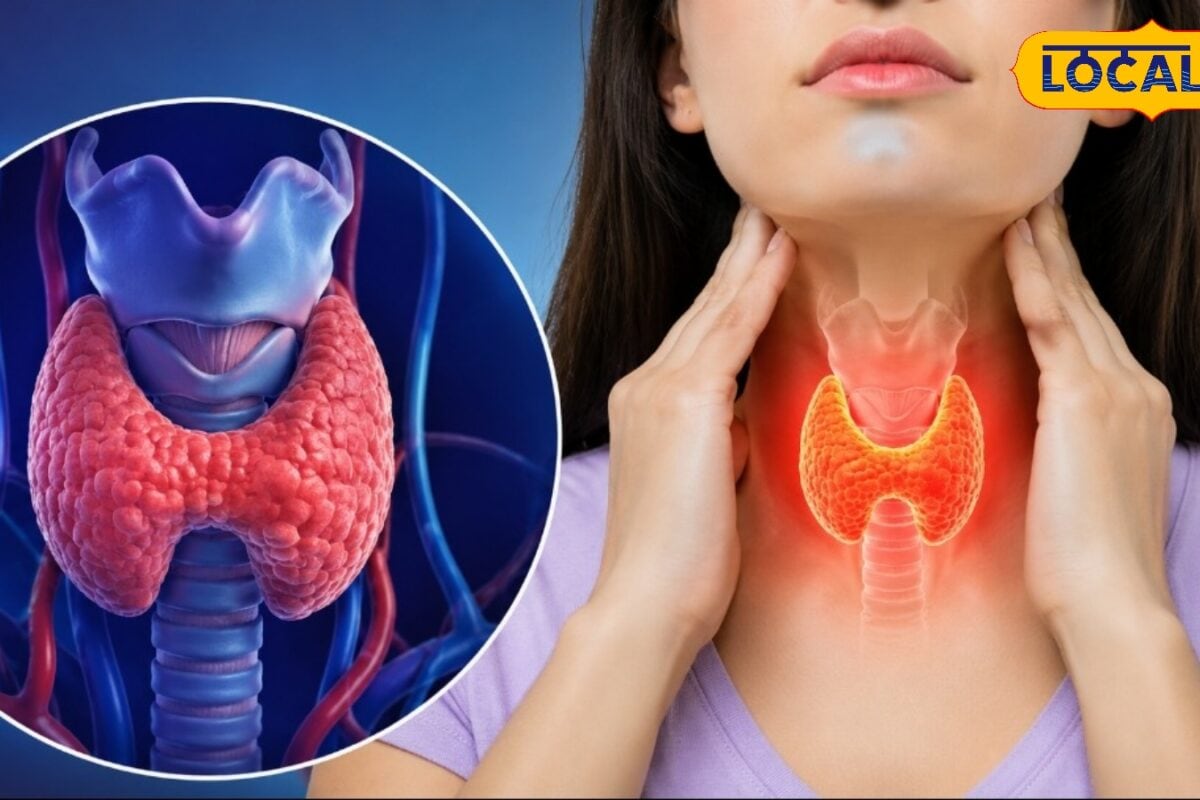 थायराइड की समस्या से हैं परेशान तो यहां जानिए कौन से घरेलू उपाय और डाइट हैं असरदार