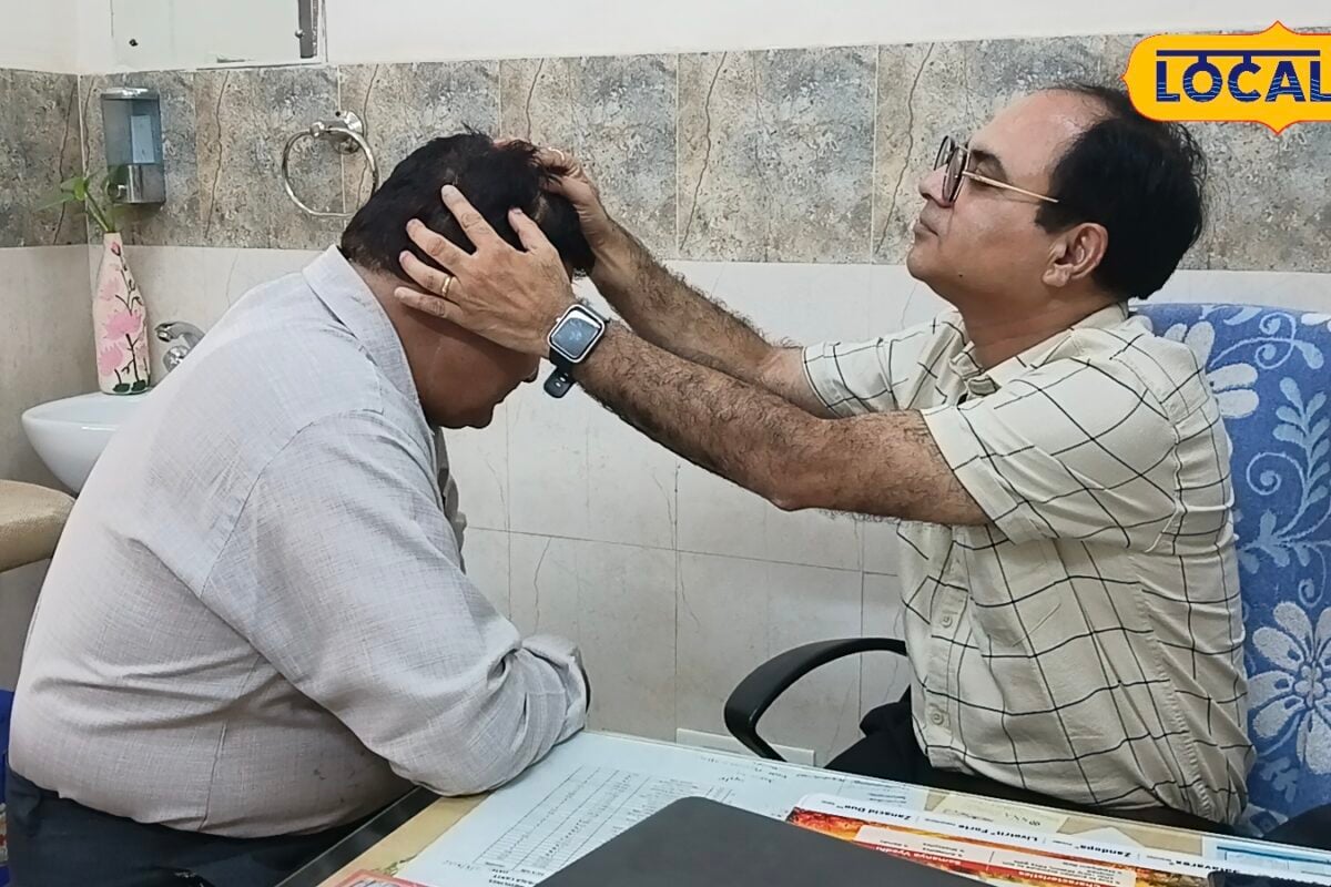 मानसून में तेजी से झड़ रहे हैं बाल आयुर्वेदिक डॉक्टर ने बताए बचाव के आसान उपाय