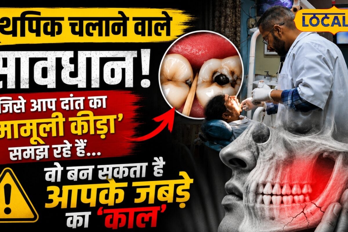 Health Tips: टूथपिक चलाने वाले सावधान! जिसे आप दांत का मामूली कीड़ा समझ रहे हैं वो बन सकता है जबड़े का काल