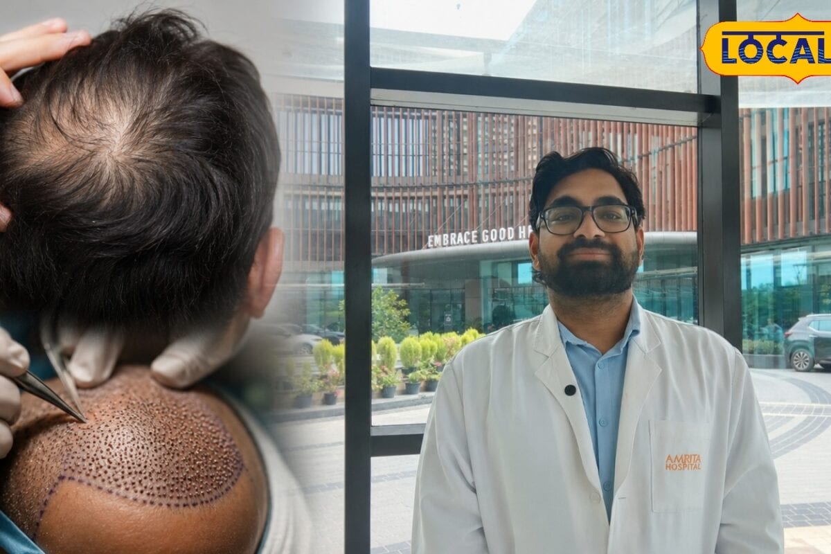20 से 30 साल  की उम्र में क्यों गंजे हो रहे युवा कौन सी तकनीक से करवाना चाहिए हेयर ट्रांसप्लांट एक्सपर्ट से जानें