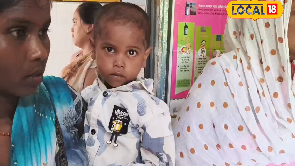 चित्रकूट में 7 अगस्त को मूक-बधिर बच्चों के लिए एमसीएच विंग अस्पताल में लगेगा निशुल्क कैंप 5 वर्ष तक के बच्चों को होगा इलाज