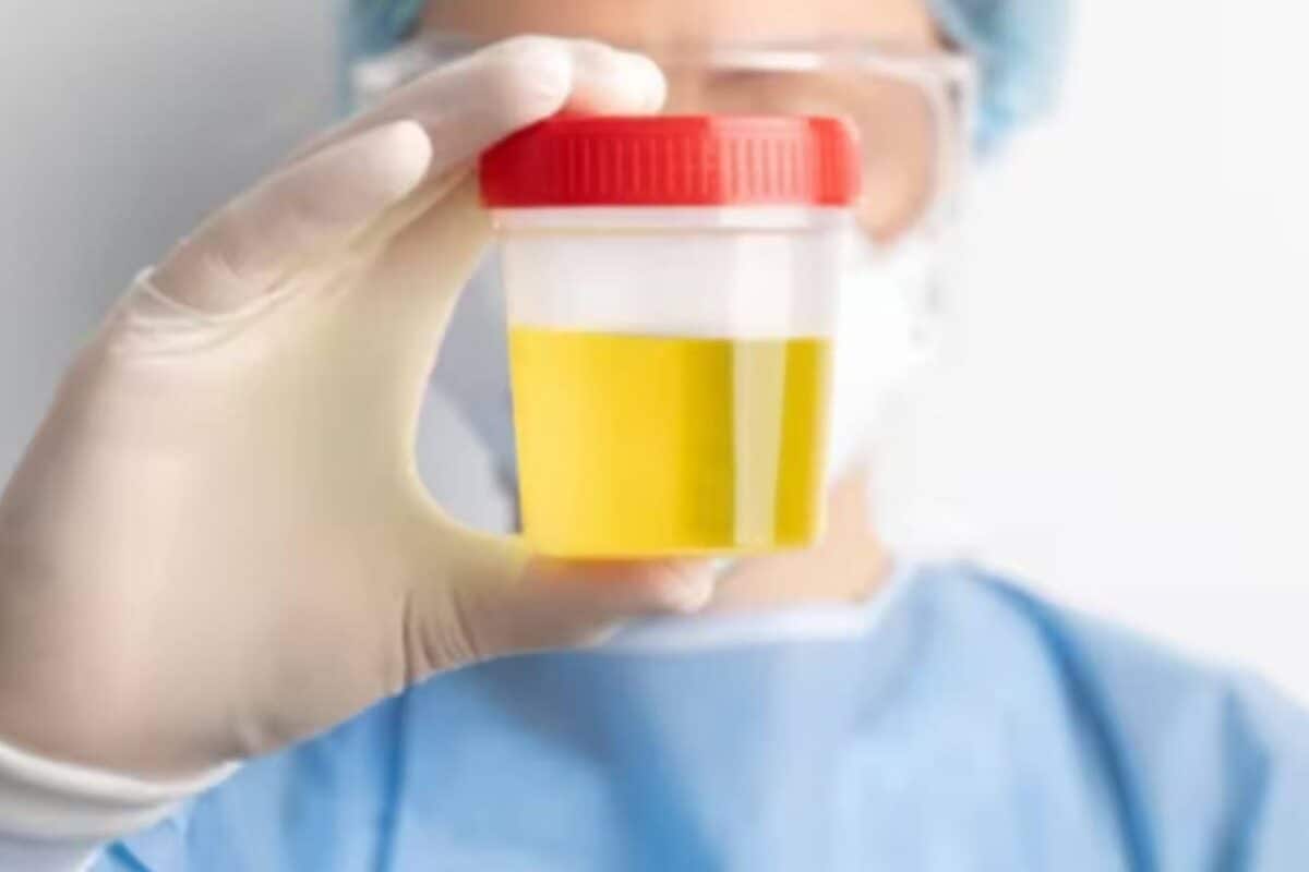 Research: यूरिया से कैसे बनता है हाइड्राज़ीन नई टेक्नीक बनाएगी पेशाब से रॉकेट फ्यूल और EV बैटरी