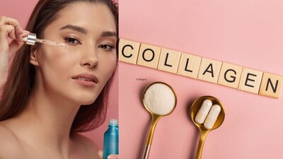 Collagen vs. Retinol: Which is Best for Wrinkles and Fine Lines? Understand the Difference