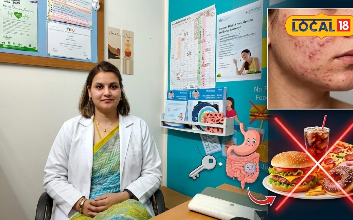 ज्यादा मीठा ऑयली फूड कुछ डेयरी प्रोडक्ट्स बढ़ा सकते हैं पिंपल्स डाइटिशियन ने बताया संतुलित आहार