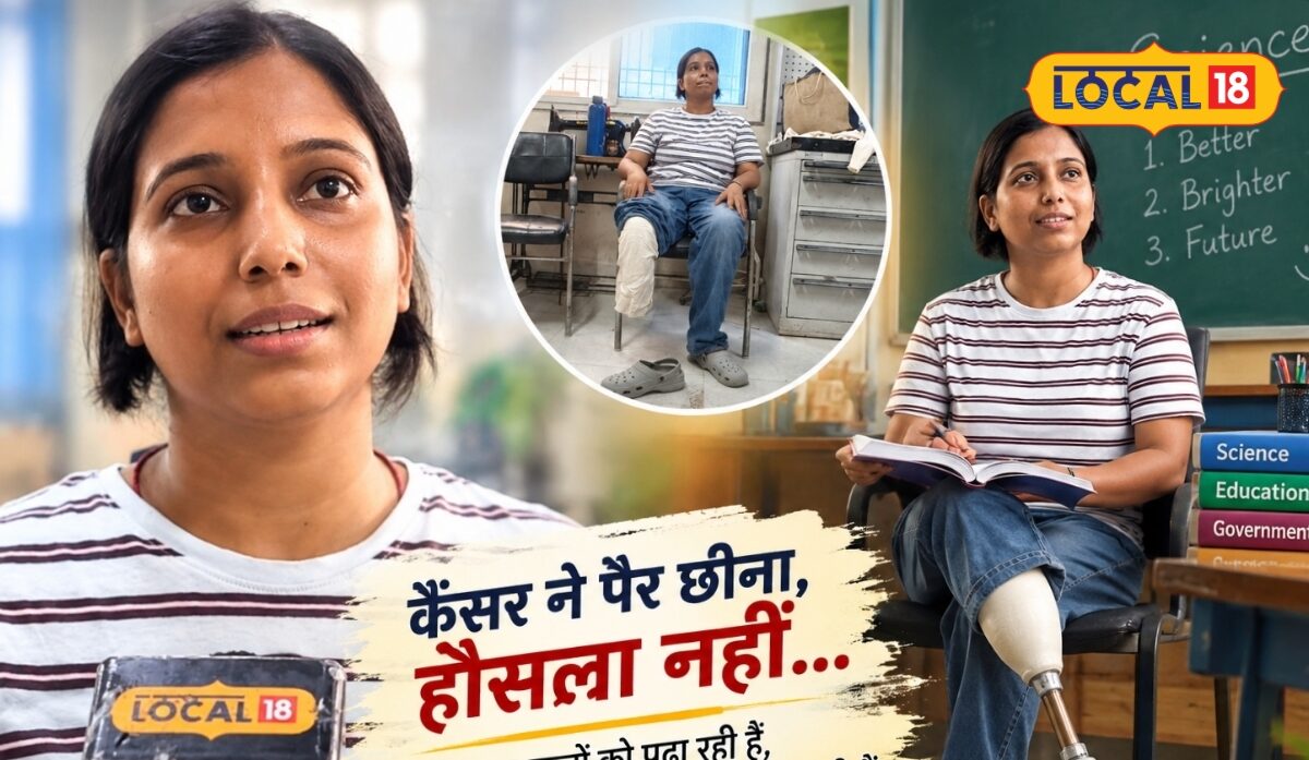ट्यूमर ने छीना पैर तो हौसले से दिया जवाब प्रोस्थेटिक लेग से लिखी नई कहानी अब बच्चों का संवार रही भविष्य
