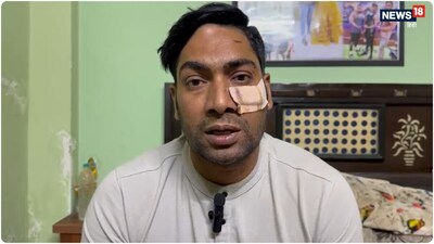 आरोपियों ने दिल्ली पुलिस के हेड कांस्टेबल का जबड़ा तोड़ दिया.