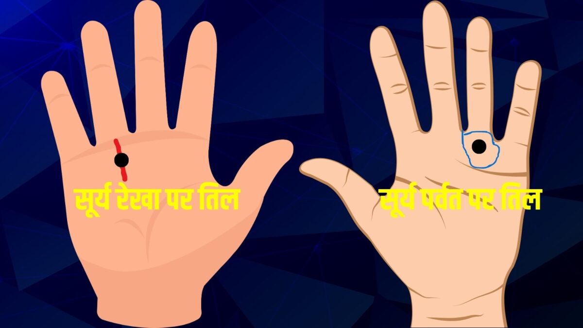 हथेली में सूर्य पर्वत और सूर्य रेखा पर तिल का क्या मतलब है? जानें ज्योतिष उपाय..