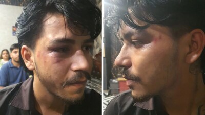 Ghaziabad: Family Attacked, Woman Molested, Husband Beaten at Child's Birthday Party in Cafe
