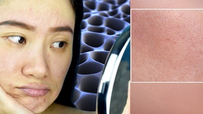 Pores Like Pits? These 7 Skincare Mistakes Are Ruining Your Routine!