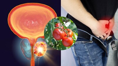 Men Over 40: 5 Must-Have Foods for a Healthy Prostate.