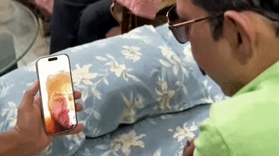 जदयू विधायक अनंत सिंह और एल्विश यादव का वीडियो कॉल वायरल