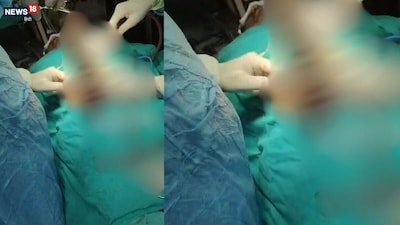 कानपुर में महिला के पेट से निकली तौलिया.
