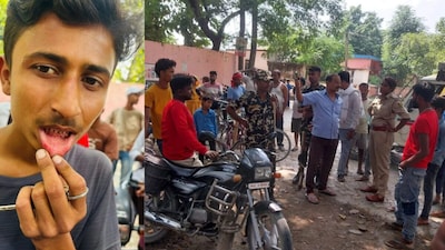 मोतिहारी में आइसक्रीम खाने से आधा दर्जन बच्चे बीमार, होंठ चिपके और खून निकले