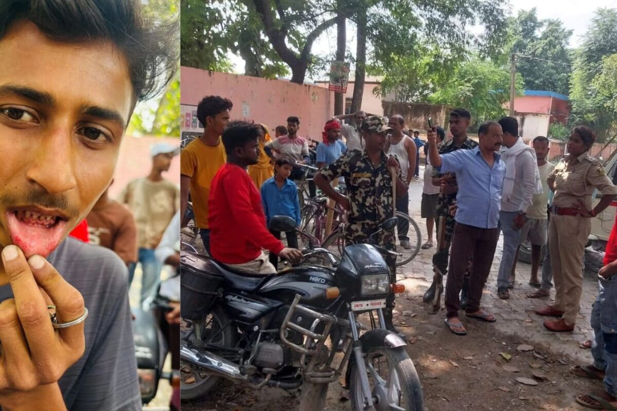 मोतिहारी में आइसक्रीम के नाम पर जहर? खाते ही बच्चों के चिपके होंठ, खींचने पर निकले खून, खतरनाक केमिकल की आशंका