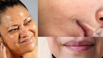 Skin Texture को सही करने का तरीका. 