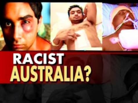 Students not the only victims of race attacks Students not the only victims of race attacks