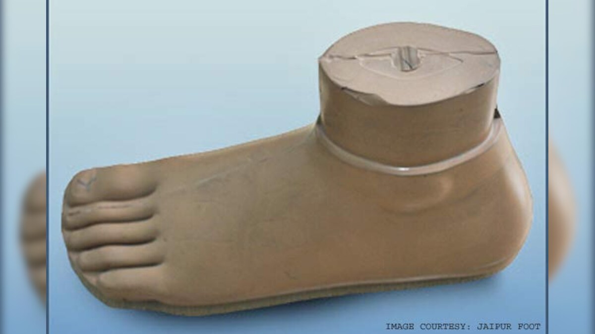 Can the Jaipur Foot survive after DR Mehta?