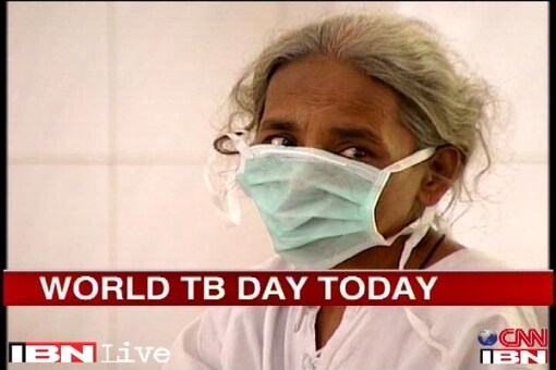Drug resistant tuberculosis on the rise