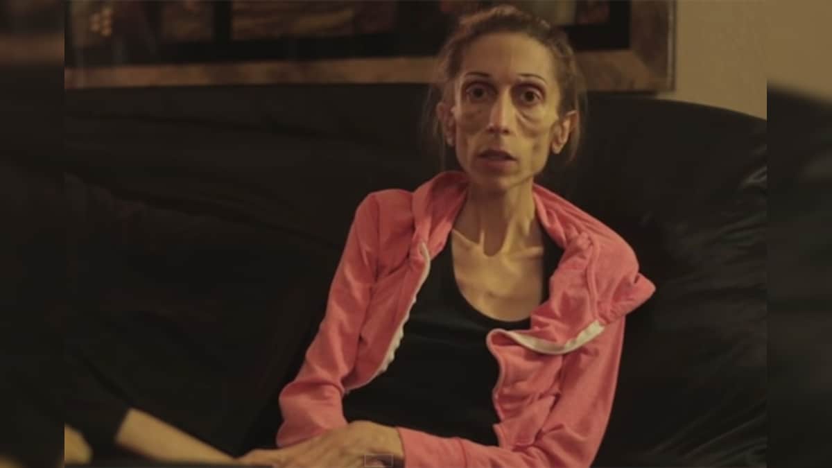 Rachael's road to recovery: the tale of a woman's battle with anorexia ...