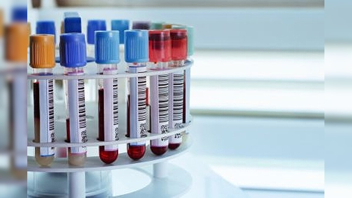 blood-test-can-detect-signs-of-breast-cancer-as-early-as-5-years