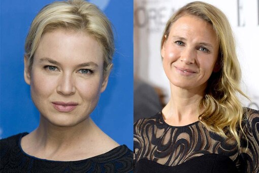Renee Zellweger Slams Speculation About Her Plastic Surgery