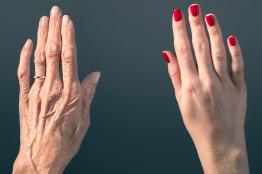3D printing, 3D printed hands