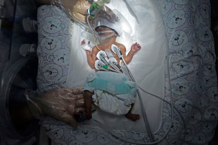 Baby Declared Dead by a Delhi Hospital Comes to Life Just Before Burial