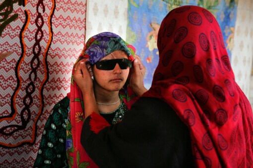 She underwent six surgeries but her eyesight, lost due to ruptured retina and optic nerve, could not be recovered. (Photo: Abid Bhat)