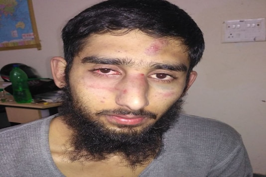 One of the students who was beaten up by a mob on Wednesday. (Photo: News18) One of the students who was beaten up by a mob on Wednesday. (Photo: News18)