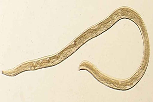 Worm Species Which Has 3 Sexes And Thrives In High Arsenic Zone Discovered In California News18