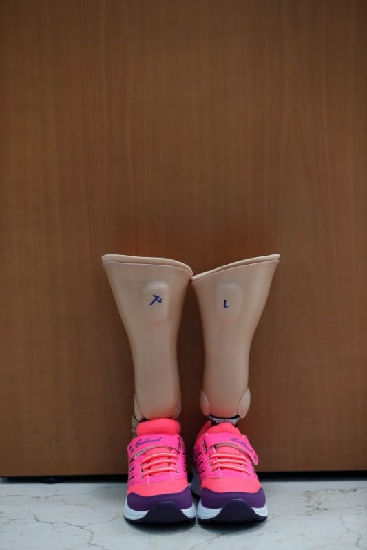 A pair of artificial limbs for Maya Meri, 8, is seen at a prosthetic center in Istanbul, Turkey, July 5, 2018. Picture taken July 5, 2018. REUTERS/Osman Orsal