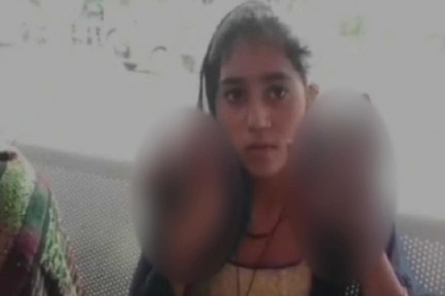 Accusing Her of Adultery, Mother-in-Law Allegedly Burns Woman's Hands on Tantrik's Advice