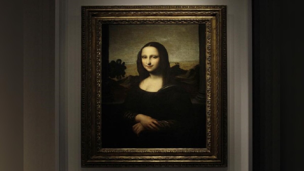 Mona Lisa: Classic Signs of Hypothyroidism in the World's Most