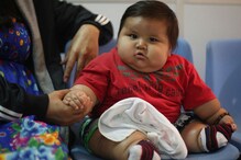 Overweight Kids Have High Risk of Suffering From High Blood Pressure