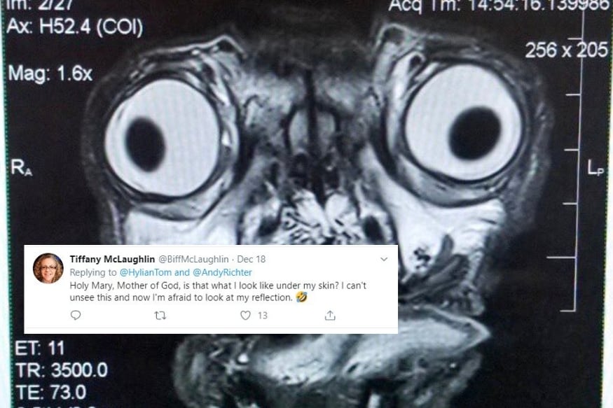 Cute or Terrifying? X-Ray of Pug’s Face Leaves Social Media Divided