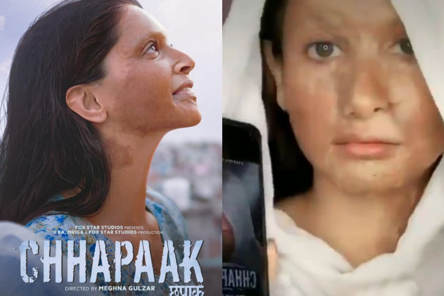 Deepika Padukone Trolled for Turning Chhapaak Look Into TikTok