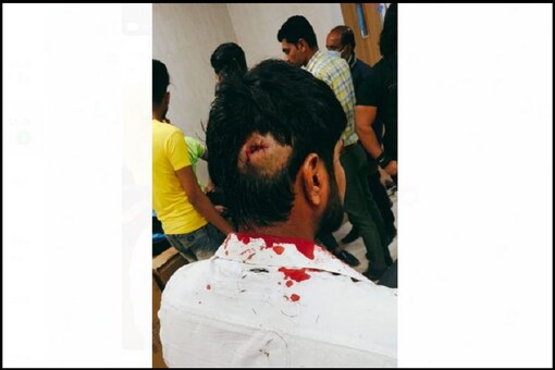 NSUI Gen Sec of Gujarat sustained grave injuries during the incident.