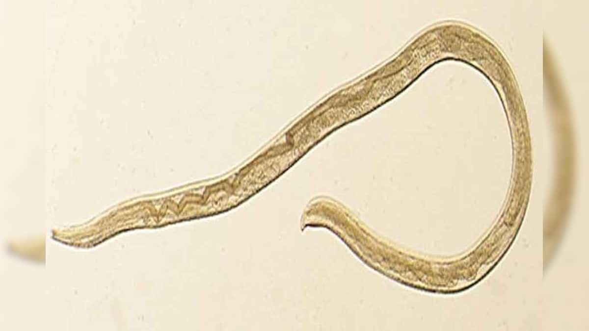 Scientists Discover New Species of Boneeating Worms During a Study