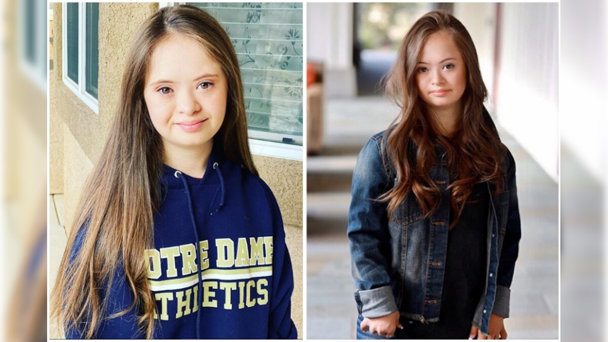 Teen Model with Down's Syndrome is Breaking Stereotypes and the Internet