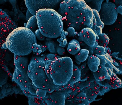 Colorized scanning electron micrograph of an apoptotic cell (blue) infected with SARS-COV-2 virus particles (red), isolated from a patient sample. (Image: NIAID-RML)