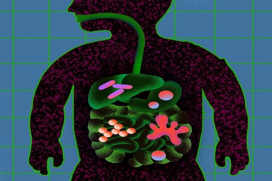 The new Covid-related inflammatory disease affecting children is scary but thankfully rare and easy to spot. (Ariel Davis/The New York Times)