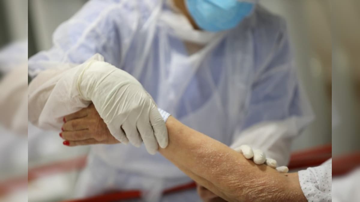 Chest Pain, Diarrhea, Severe Acid Reflux, Unbearable Nausea Covid19 Patient Lists 'Terrifying