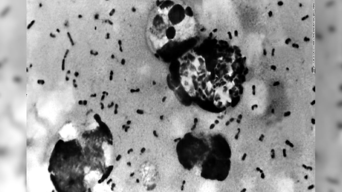 Everything to Know About Bubonic Plague As It Spreads Again