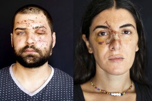 Lebanon Blast: Survivors of Beirut Explosion Face the Camera