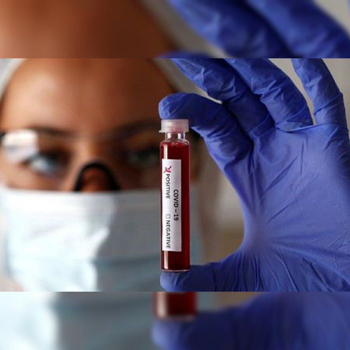 Blood Group O Likely to Have Lower Risk of Coronavirus ...