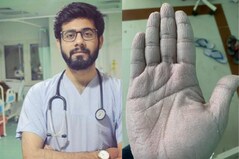 'Can't Take Off Gloves For Over 10 Hours': What Happens to a Doctor's Hands in a Covid-19 Ward