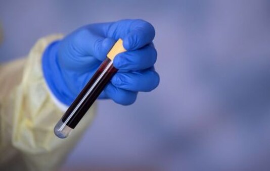 Nearly 8% of people in German coronavirus hotspot had COVID-19 - RKI