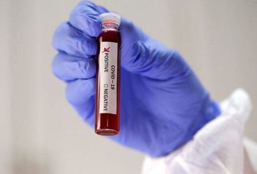Two European Patients Re-infected With Coronavirus