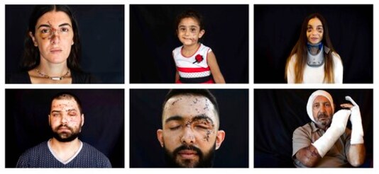 AP PHOTOS: Scars from Beirut blast capture moment of horror