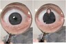 Instagram Animator Films Himself Sitting Inside His Eye. Here's How He Did it